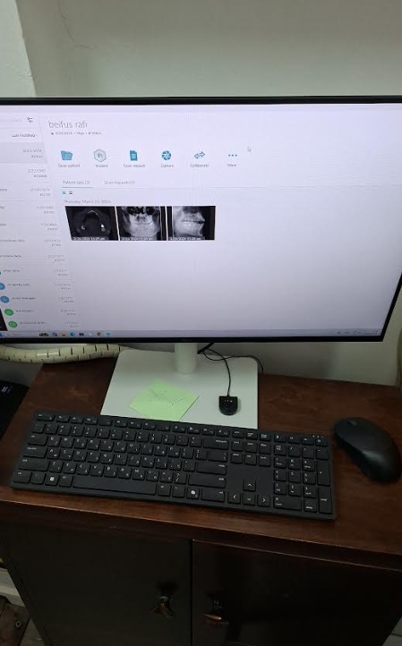 אופן ביצוע הבדיקה צילום סיטי שיניים