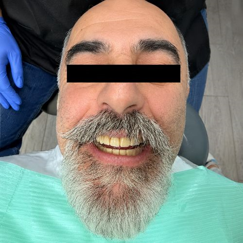 אחרי סידור שיניים